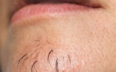 Kinnbehaarung bei Frauen ist ein Zeichen für… Mehr anzeigen
