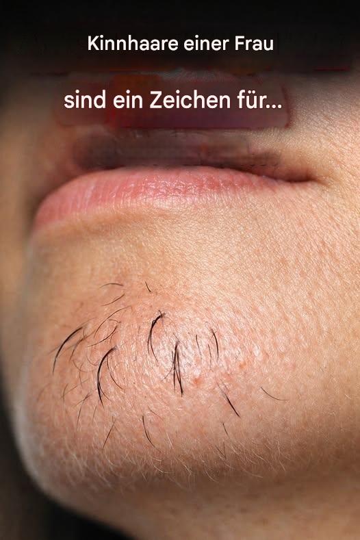 Kinnbehaarung bei Frauen ist ein Zeichen für… Mehr anzeigen