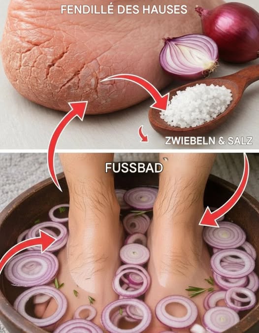 Das Geheimnis weicher Füße: Ein natürliches Hausmittel mit Zwiebeln und Salz gegen rissige Fersen