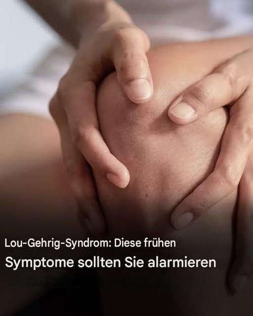 Lou-Gehrig-Syndrom: Hier sind die ersten Symptome dieser Krankheit